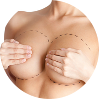 Risultati immagini per chirurgia al seno